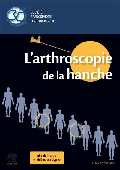 L'arthroscopie de la hanche - Olivier May - broché