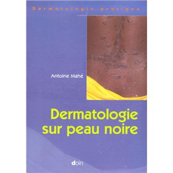 Dermatologie sur peau noire - 1