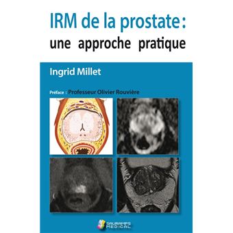 Irm de la prostate : une approche pratique - 1