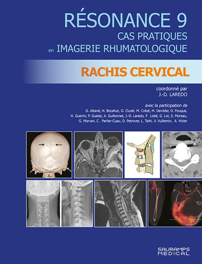 Resonance 9. rachis cervical - Jean-Daniel Laredo - broché
