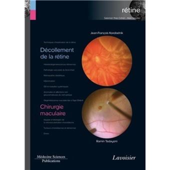 Décollement de la rétine / Chirurgie maculaire (volume 6 - coffret Rétine)