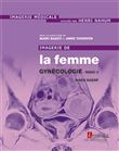 Imagerie de la femme : Gynécologie - Tome 2