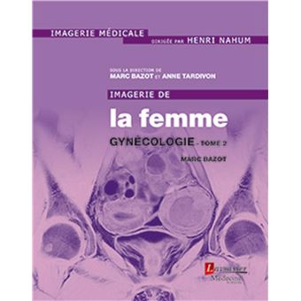 Imagerie de la femme : Gynécologie - Tome 2