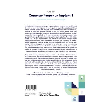 Comment louper un implant