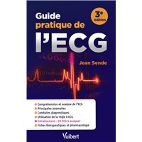 Guide pratique de l'ECG
