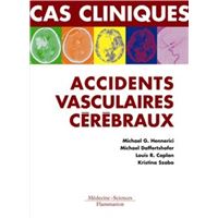 Accidents vasculaires cérébraux. Formes cliniques habituelles et inhabituelles