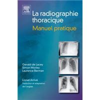 La radiographie thoracique. Manuel pratique