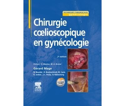 Chirurgie coelioscopique en gynécologie - Gérard Mage - broché