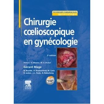 Chirurgie coelioscopique en gynécologie - 1