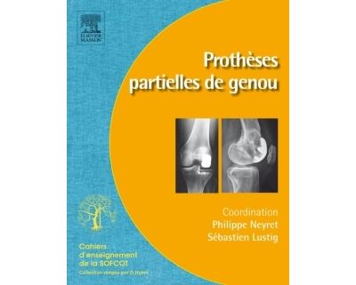 Prothèses partielles de genou - Philippe Neyret - broché