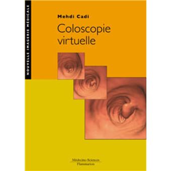 Coloscopie virtuelle