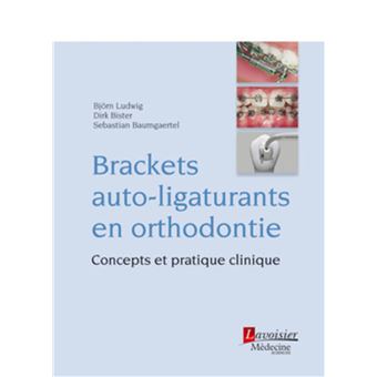 Brackets auto-ligaturants en orthodontie