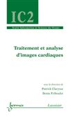 Traitement et analyse d'images cardiaques