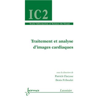 Traitement et analyse d'images cardiaques