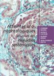 Atteintes uro-néphrologiques au cours des maladies systémiques