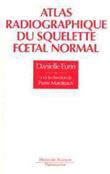 Atlas radiographique du squelette foetal normal