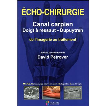 Echo-chirurgie canal carpien, doigt a ressaut et dupuytren - 1