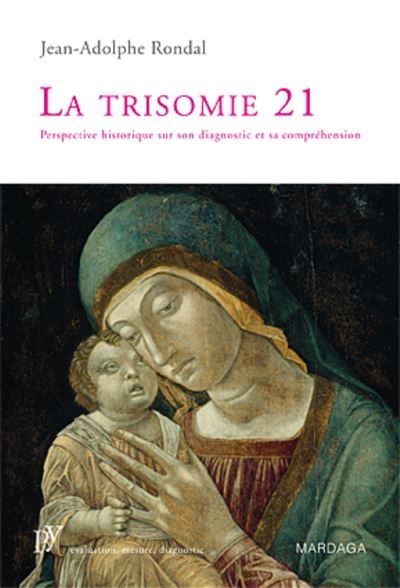 La trisomie 21 Perspective historique sur son diagnostic et 