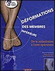 Déformations des membres inférieurs