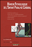 Marche pathologique de l'enfant paralysé cérébral