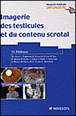Imagerie des testicules et du contenu scrotal