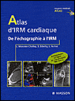 Atlas d'imagerie cardiaque, de l'échographie à l'IRM