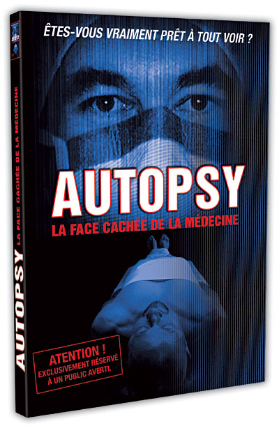 Autopsy - La face cachée de la médecine