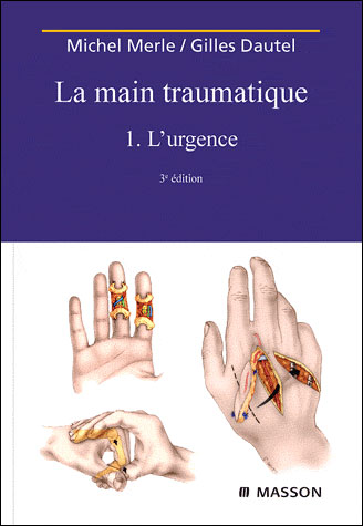 La main traumatique