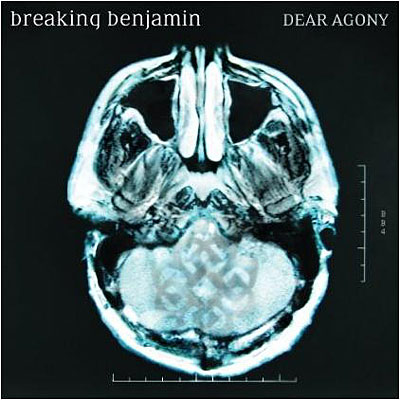 Dear agony