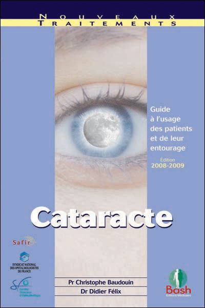 Cataracte